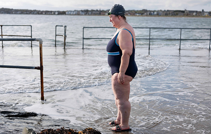 Understanding the long-term impact of obesity on health